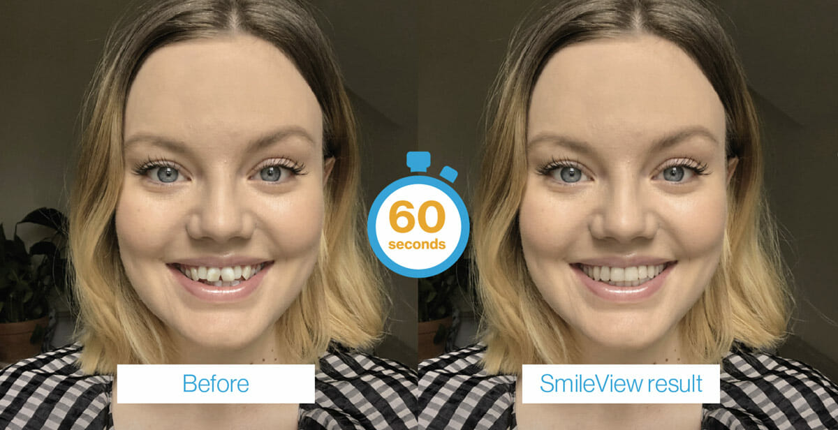 Dentist Mill Hill - Smiles by hillside